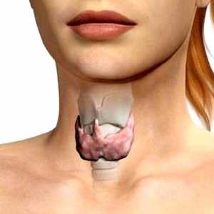 Modificări difuză a glandei tiroide