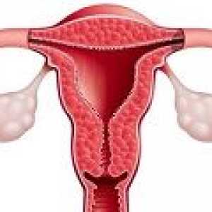 Ovarian Disfuncție - cauze, simptome, tratament