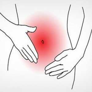 Sângerarea uterină disfuncțională