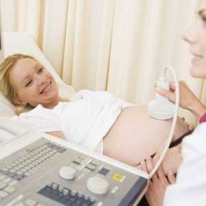 Ecografia Doppler în timpul sarcinii - ce este?