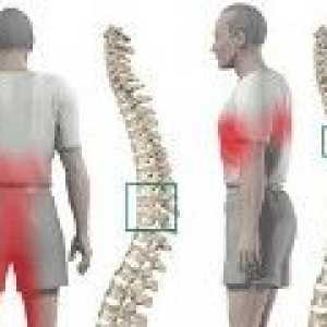 Toracice osteohondroză: simptome si tratament