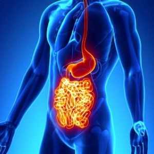 Simptomele caracteristice si tratamente pentru boala Crohn