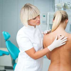 Cum de a recunoaște și de a trata melanomul a coloanei vertebrale