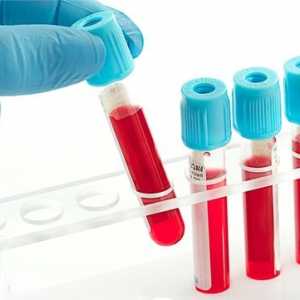 Care este rata de hemoglobină din sânge femeilor?