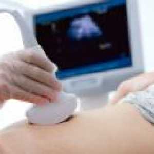 Când a face prima ecografie în timpul sarcinii?