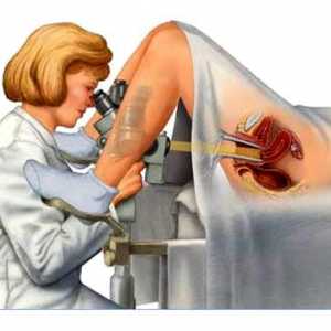 Colposcopie de col uterin - tipuri și indicații