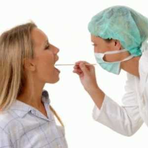 Tratamentul faringită - tratamentul remedii populare