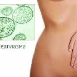 Tratamentul cu Ureaplasma la femei, la bărbați