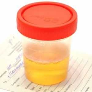 Leucocitele din cauze urină a crescut