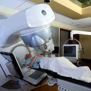 Radioterapia: ceea ce este și ceea ce sunt consecințele