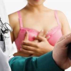 Mastectomia - o operație de îndepărtare a sanului