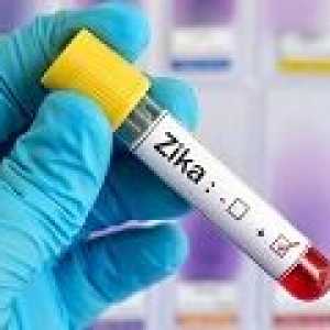 Meningoencefalită - una dintre complicațiile virusului Zika