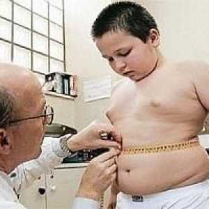 Metformina este ineficient în tratamentul obezității copilarie