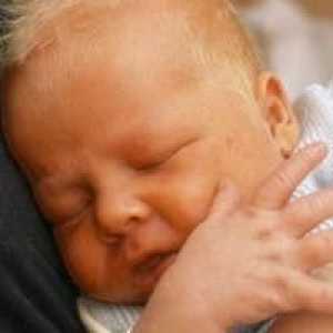 Norma bilirubina la nou-nascuti
