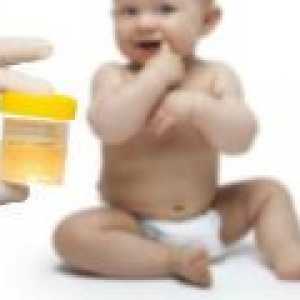 Norme de urină la adulți, la copii