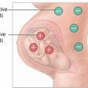 Rh factor negativ în timpul sarcinii