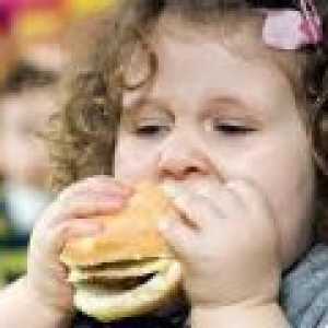 Obezitatea la copii - simptome, tratament, comentarii