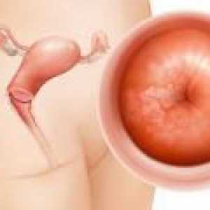 Papilloma de col uterin, cauze, simptome și tratament