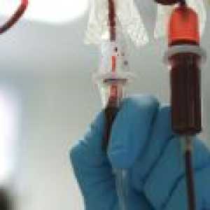 Transfuzia de sânge dintr-o venă în fesă