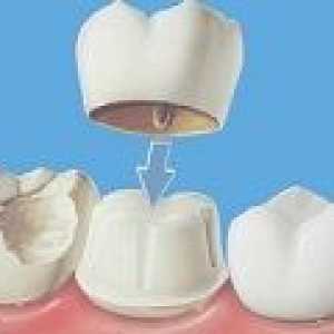 De ce durere de dinți sub sigiliu?