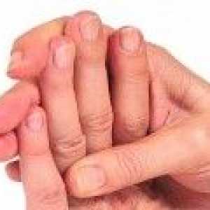 De ce degetele amorțite de mâna stângă, motivele