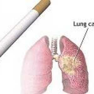 Cauzele cancerului pulmonar la fumatori
