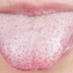 Cauzele uscăciunea gurii și a limbii de acoperire