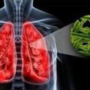 Cauzele de tuberculoză pulmonară