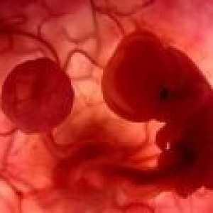 Cauzele de avort la inceputul sarcinii