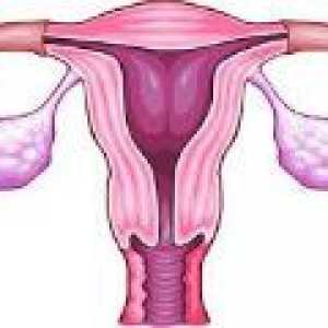 Retentie chisturi ovariene - cauze, simptome, tratament