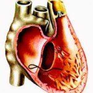 Astm cardiac