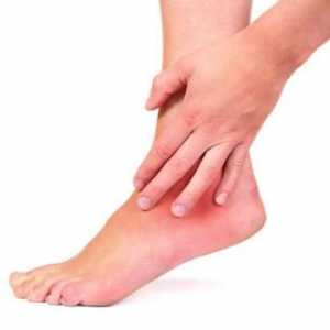 Simptomele și tratamentul artritei glezna