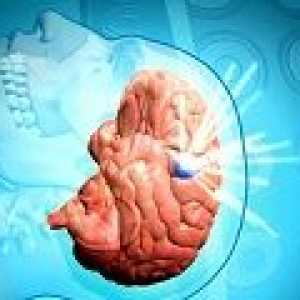 Hematom subdural a creierului: cauzele, simptome, tratament