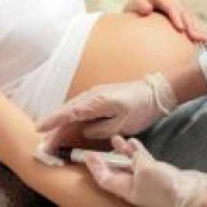 Coagularea sângelui în timpul sarcinii, rata de patologie