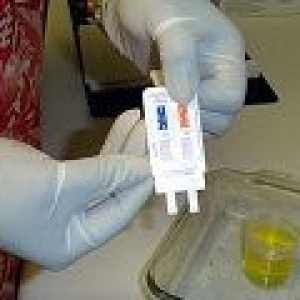 Teste de droguri pentru a verifica pentru adolescenți