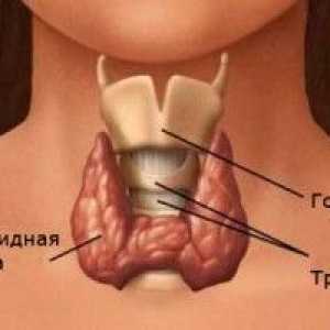 Tiroidita Hashimoto (tiroidita Hashimoto) - cauze, simptome și tratament