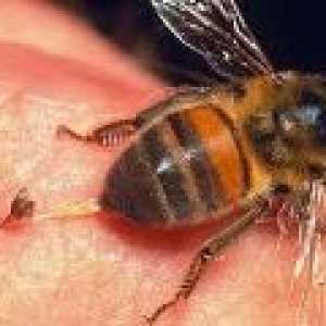 Intepatura de o albină, viespe, Hornet: Tratamente