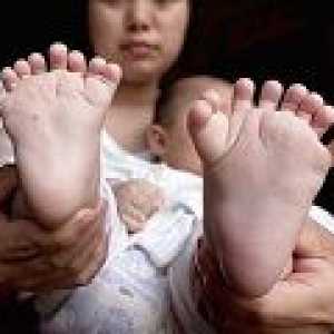 În China, un copil sa nascut cu 31 de degete