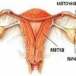 Inflamație a ovarelor - (ooforitei) la femei