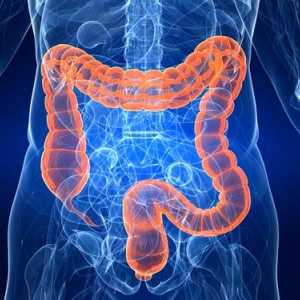 Boala inflamatorie intestinală: simptome și tratament