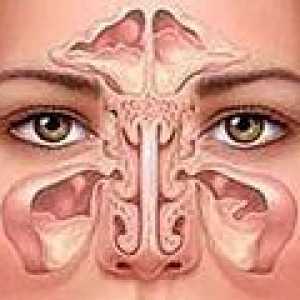 Inflamația sinusurilor, simptome și tratament