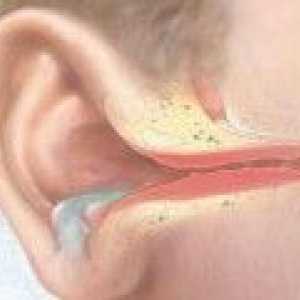 Inflamația urechii medii: cauze, tratament