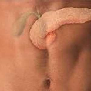 Inflamarea vezicii biliare, căile de atac de tratament populare