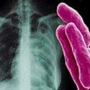 Agentul cauzal al tuberculozei. Cum este TB?