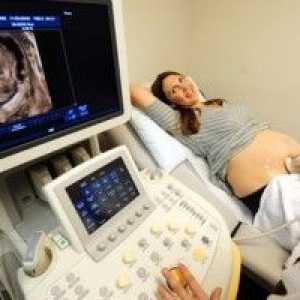 Dacă ultrasunete dăunătoare în timpul sarcinii? De câte ori se poate face?