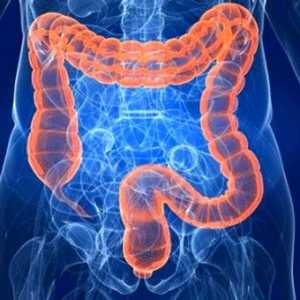 Boala intestinului: simptome