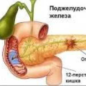 Boli ale pancreasului