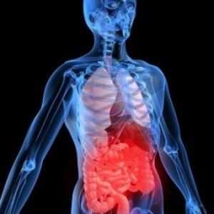 Hemoragii gastro-intestinale, simptome și tratament