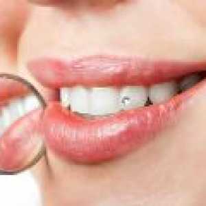 Plombele dentare - Criterii de selecție